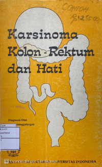 Image of Karsinoma Kolon-Rektum dan Hati