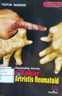 Image of Mengungkap Luka Bakar & Artritis Reumatoid